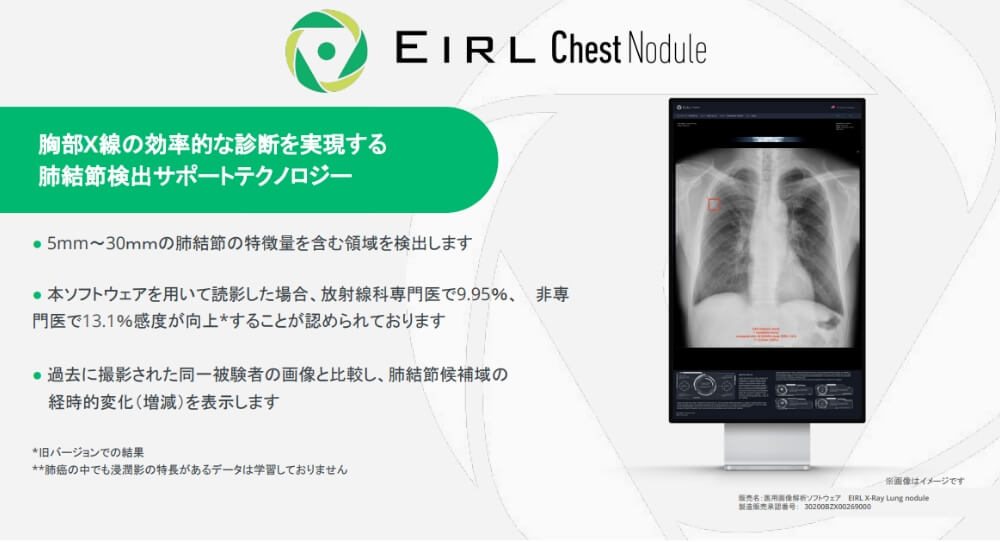 薬事承認済みの高精度AI