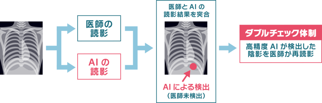 イリモトメディカルと大日本印刷株式会社が共同開発した「AI支援胸部がん検診読影システム」のイメージ